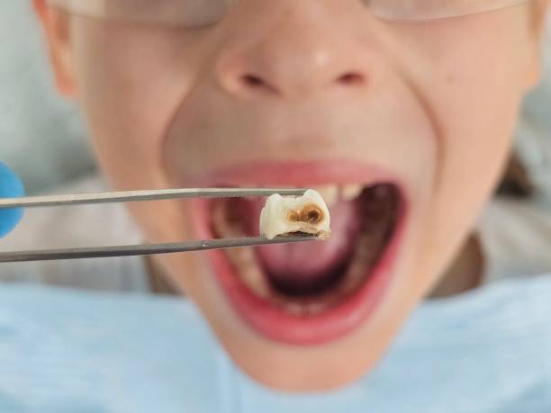 Best Broken or Cracked Tooth Emergency Dentist in Skagway, AK